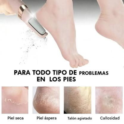 REMOVEDOR DE CALLOS RECARGABLE
